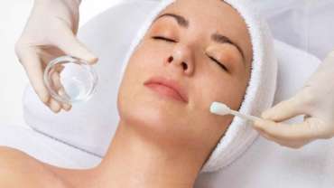 Chemical Peels