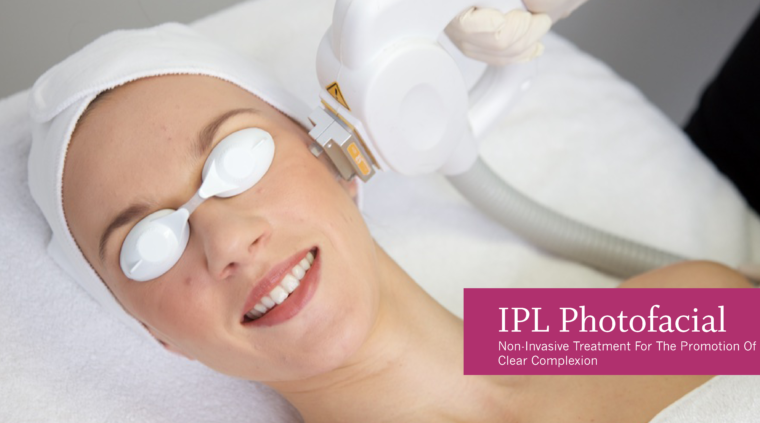 Photofacial