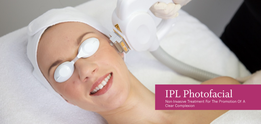 Photofacial